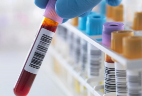 This simple blood test can predict cancer years before symptoms appear